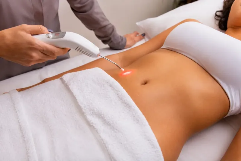 Laserterapia