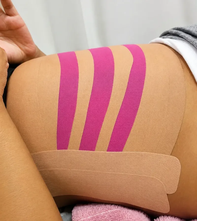 Taping Pós-Parto e Pós-Operatório
